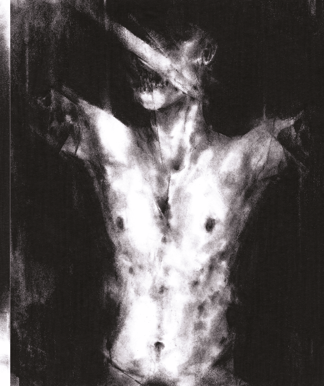 Dehiscence